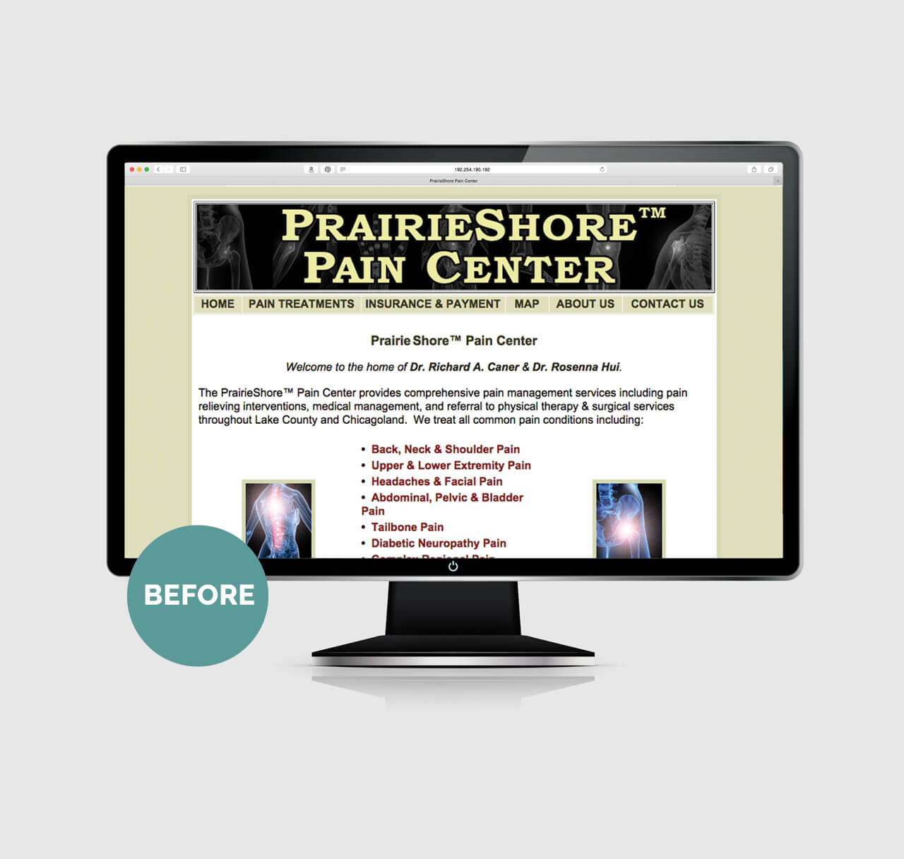 PrairieShore before image